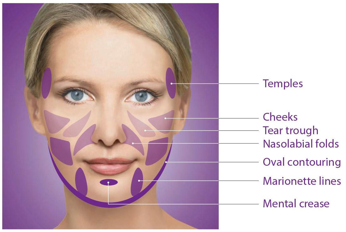 facial hollowness